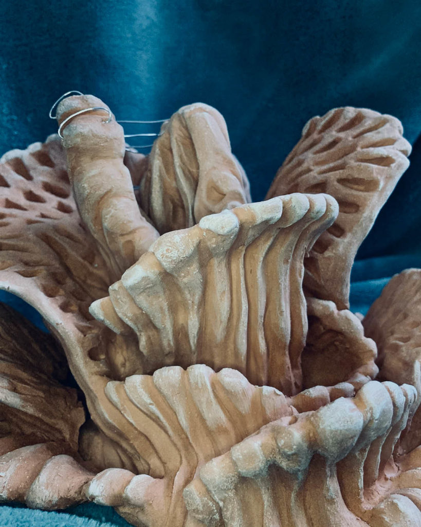 How 3 Shriners Hospital Patients Used Art to Heal Chicago Parent